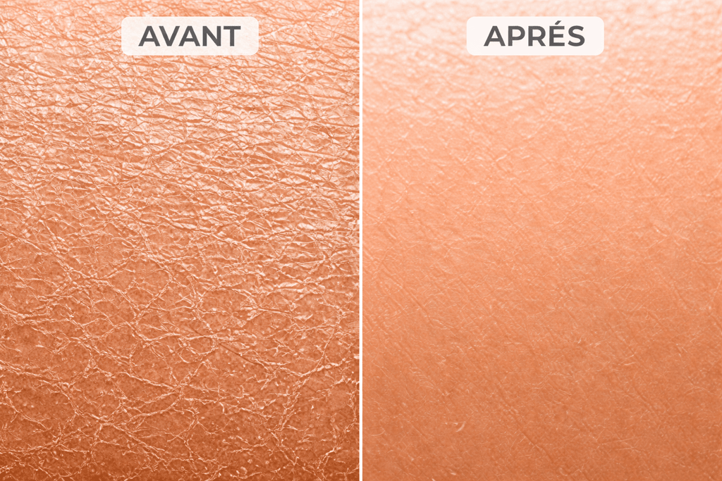 Gant exfoliant kératose pilaire - Freshpalm™