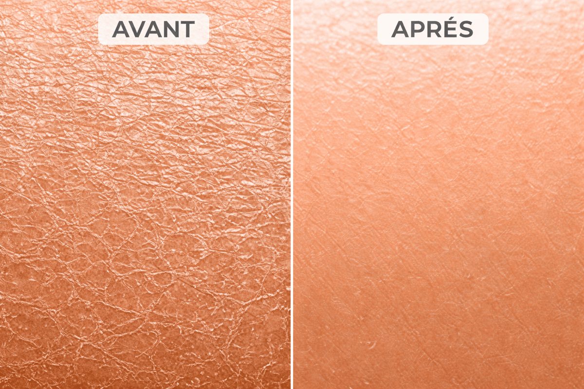 Gant exfoliant kératose pilaire - Freshpalm™